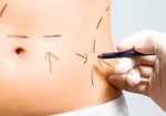 cirurgia-plastica-ipiranga-1428501926